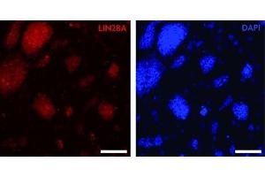 Immunocytochemical analysis of LIN28A staining of mouse embryonic stem cells. (LIN28A antibody  (C-Term))