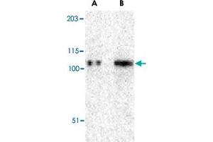 Western blot analysis of TRPC6 in K-562 cell lysate with TRPC6 polyclonal antibody  at (A) 0. (TRPC6 antibody  (N-Term))