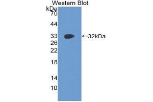 Western Blotting (WB) image for anti-Insulin-Like Growth Factor 2 mRNA Binding Protein 2 (IGF2BP2) (AA 141-384) antibody (ABIN1859297)