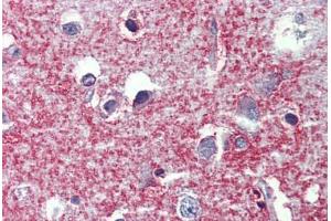 Human Brain, cortex: Formalin-Fixed, Paraffin-Embedded (FFPE) (SHROOM2 antibody  (AA 1554-1616))