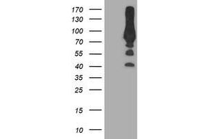 Western Blotting (WB) image for anti-phosphofructokinase, Platelet (PFKP) antibody (ABIN1500165) (PFKP antibody)
