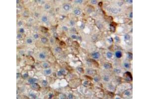 Used in DAB staining on fromalin fixed paraffin-embedded liver tissue (DDOST antibody  (AA 29-412))