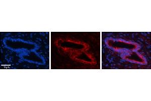 Rabbit Anti-SLBP Antibody     Formalin Fixed Paraffin Embedded Tissue: Human Bronchial Epithelial Tissue  Observed Staining: Cytoplasmic  Primary Antibody Concentration: 1:100  Secondary Antibody: Donkey anti-Rabbit-Cy3  Secondary Antibody Concentration: 1:200  Magnification: 20X  Exposure Time: 0. (SLBP antibody  (Middle Region))