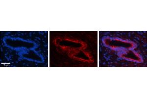 Rabbit Anti-SLBP Antibody     Formalin Fixed Paraffin Embedded Tissue: Human Bronchial Epithelial Tissue  Observed Staining: Cytoplasmic  Primary Antibody Concentration: 1:100  Secondary Antibody: Donkey anti-Rabbit-Cy3  Secondary Antibody Concentration: 1:200  Magnification: 20X  Exposure Time: 0. (SLBP antibody  (Middle Region))