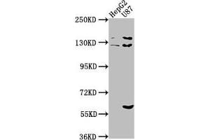 Western Blot Positive WB detected in: HepG2 whole cell lysate, U87 whole cell lysate All lanes: ST5 antibody at 1:2000 Secondary Goat polyclonal to rabbit IgG at 1/50000 dilution Predicted band size: 127, 83, 71 kDa Observed band size: 127 kDa