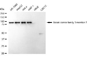 Western blotting analysis using Solute carrier family 3 member 2 antibody (ABIN7800395).