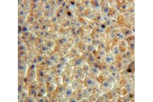 Used in DAB staining on fromalin fixed paraffin-embedded Liver tissue (SERPINB3 antibody  (AA 1-210))