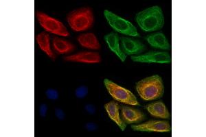 ABIN6260850 and ABIN6273034 staining Hela cells by IF/ICC. (CKAP4 antibody  (C-Term))