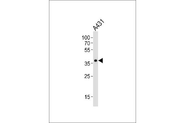 MUL1 antibody  (AA 176-210)