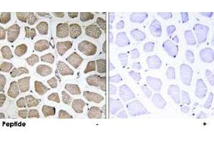 Immunohistochemistry analysis of paraffin-embedded human skeletal muscle tissue using SLC16A12 polyclonal antibody . (SLC16A12 antibody)