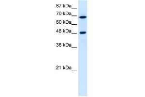 RRP9 antibody used at 5 ug/ml to detect target protein. (RRP9 antibody  (Middle Region))