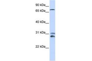 Image no. 1 for anti-Tousled-Like Kinase 2 (TLK2) (AA 176-225) antibody (ABIN6744261)