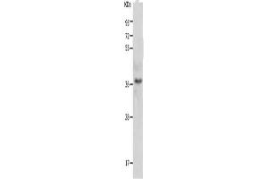 CTRP5 antibody