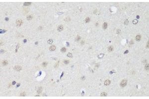 Immunohistochemistry of paraffin-embedded Rat brain using CTCF Polyclonal Antibody at dilution of 1:200 (40x lens). (CTCF antibody)