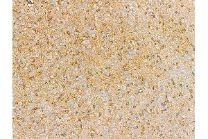 ABIN6257890 and ABIN6274946 at 1/100 staining Rat brain tissue by IHC-P. (CAGE1 antibody  (C-Term))