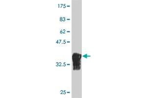 Western Blot detection against Immunogen (36. (NOC3L antibody  (AA 702-800))