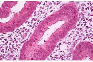 Anti-GALNT7 antibody IHC staining of human uterus, endometrium.