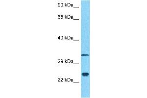 Host:  Rabbit  Target Name:  NCS1  Sample Type:  MDA-MB-435s Whole Cell lysates  Antibody Dilution:  1. (NCS1 antibody  (N-Term))