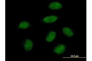 Immunofluorescence of purified MaxPab antibody to SNAI1 on HeLa cell. (SNAIL antibody  (AA 1-264))
