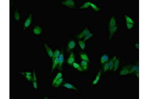 Immunofluorescent analysis of Hela cells using ABIN7150068 at dilution of 1:100 and Alexa Fluor 488-congugated AffiniPure Goat Anti-Rabbit IgG(H+L) (DLG1 antibody  (AA 662-773))