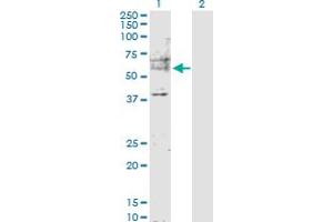 Western Blotting (WB) image for anti-Mdm2, p53 E3 Ubiquitin Protein Ligase Homolog (Mouse) (MDM2) (AA 1-491) antibody (ABIN517805)