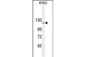 ARHG Antibody (N-term) (ABIN654716 and ABIN2844405) western blot analysis in K562 cell line lysates (35 μg/lane). (ARHGAP17 antibody  (N-Term))