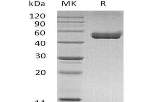 Western Blotting (WB) image for HLA-DR-gamma (CD74) protein (His tag,mFc Tag) (ABIN7320543) (CD74 Protein (His tag,mFc Tag))