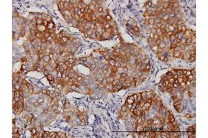 Immunohistochemistry (Formalin-fixed Paraffin-embedded Sections) (IHC (fp)) image for anti-Eukaryotic Translation Initiation Factor 4 gamma 3 (EIF4G3) (AA 1-515) antibody (ABIN563748)