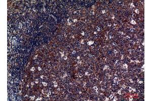 Immunohistochemistry (IHC) analysis of paraffin-embedded Human Tonsils, antibody was diluted at 1:100. (GP5 antibody  (Internal Region))