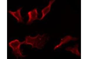 anti-Fc Fragment of IgG, Low Affinity IIc, Receptor For (CD32) (FCGR2C) (C-Term) antibody