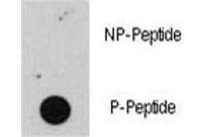 Dot blot analysis of phospho-Rb antibody. (Retinoblastoma Protein (Rb) antibody  (pSer608))