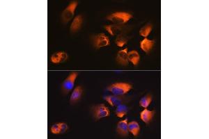 Immunofluorescence analysis of U-251MG cells using M1 Rabbit mAb (ABIN7265448) at dilution of 1:100 (40x lens). (AP2M1 antibody)