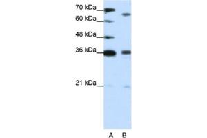 Western Blotting (WB) image for anti-PR Domain Containing 13 (PRDM13) antibody (ABIN2461914)