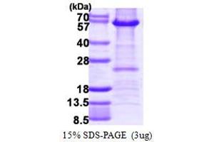 SDS-PAGE (SDS) image for Histone Deacetylase 2 (HDAC2) (AA 1-488) protein (His tag) (ABIN667944) (HDAC2 Protein (AA 1-488) (His tag))