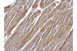 Immunohistochemistry (IHC) image for anti-Nuclear Factor-kB p65 (NFkBP65) (Center) antibody (ABIN2855287)