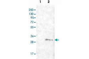 FAM82B antibody