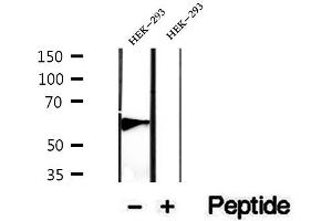 Western blot analysis of extracts of HEK-293 cells, using PHF17 antibody. (PHF17 antibody  (C-Term))