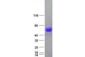 Validation with Western Blot (SLC9A3R1 Protein (Myc-DYKDDDDK Tag))