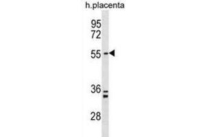 Western Blotting (WB) image for anti-PAP Associated Domain Containing 5 (PAPD5) antibody (ABIN3000215)