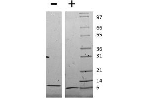 SDS-PAGE (SDS) image for Chemokine (C-C Motif) Ligand 8 (CCL8) protein (ABIN6699658)