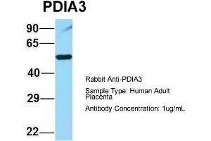 Western Blotting (WB) image for anti-Protein Disulfide Isomerase Family A, Member 3 (PDIA3) (C-Term) antibody (ABIN2774375)