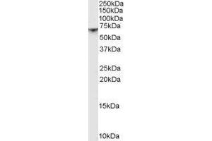 Western Blotting (WB) image for P21-Activated Kinase 1 (PAK1) peptide (ABIN369515) (P21-Activated Kinase 1 (PAK1) Peptide)