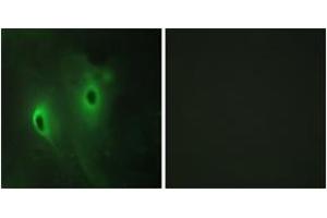 Immunofluorescence analysis of HeLa cells, using DUSP9 Antibody. (DUSP9 antibody  (AA 151-200))