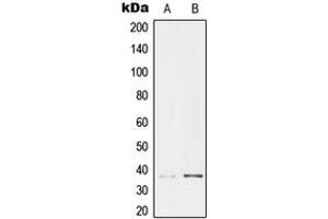 Western blot analysis of TCF19 expression in HeLa (A), HEK293 (B) whole cell lysates. (TCF19 antibody  (Center))