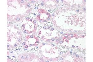 Anti-TM9SF4 antibody IHC of human, kidney. (TM9SF4 antibody  (Internal Region))