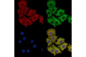 ABIN7093777 and ABIN7097818 staining HepG2 cells by IF/ICC.