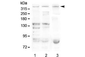 Western blot testing of Dystrophin antibody and Lane 1:  human SMMC-7721