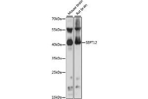 Western blot analysis of extracts of various cell lines, using SEPT12 antibody (ABIN6291643) at 1:1000 dilution. (Septin 12 antibody)