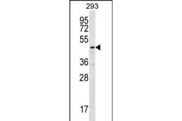 TBCEL antibody  (C-Term)