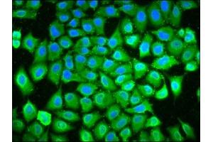 Immunofluorescence staining of Hela cells with ABIN7163852 at 1:133, counter-stained with DAPI. (POLDIP3 antibody  (AA 100-221))